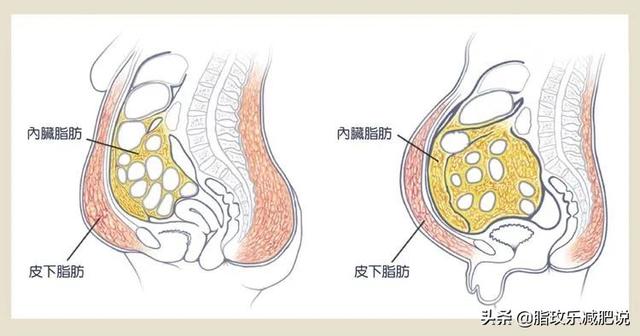 减掉你的大肚腩4个步骤搞定（3种方法甩掉3类大肚子）(3)