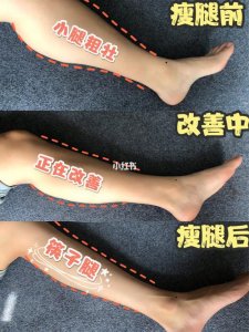 ​儿童怎么瘦腿（儿童瘦腿方法）