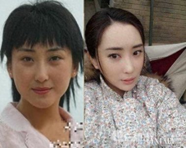 ​她整容前丑到哭！疑与‘当红小生’严宽离婚，揭秘离婚内幕