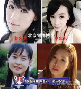 ​女星姚芊羽整容变残 韩女星李多海再度变脸