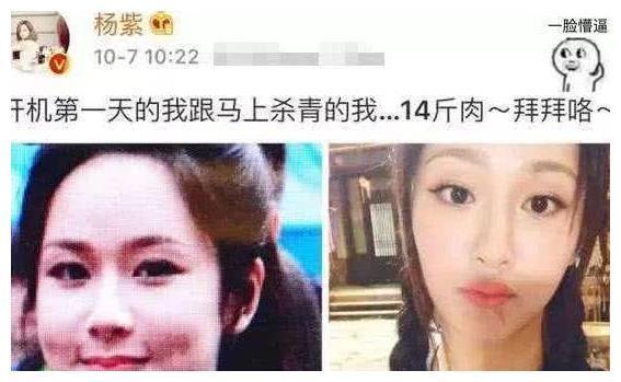 杨紫自曝减肥秘籍，15天瘦22斤，网友：怪不得一下子变化这么大